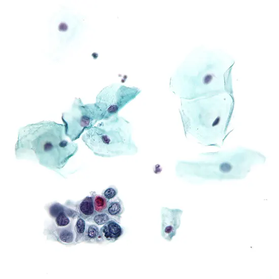 cytology (pap smear) genital female, conventional test